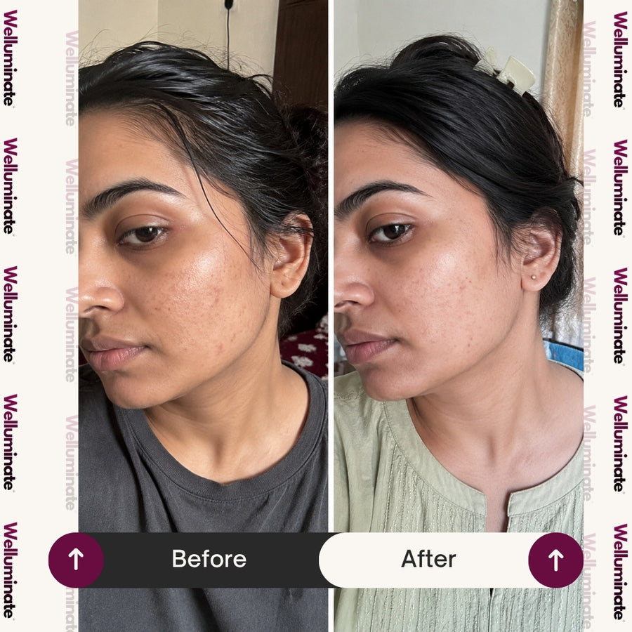 Dark spots gone!