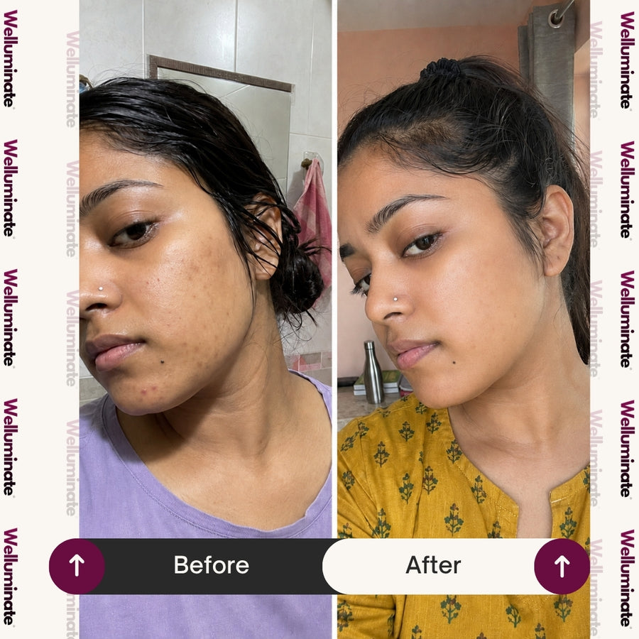 Pigmentation and dark spots gone!